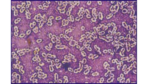 Bacterial Capsule Stain