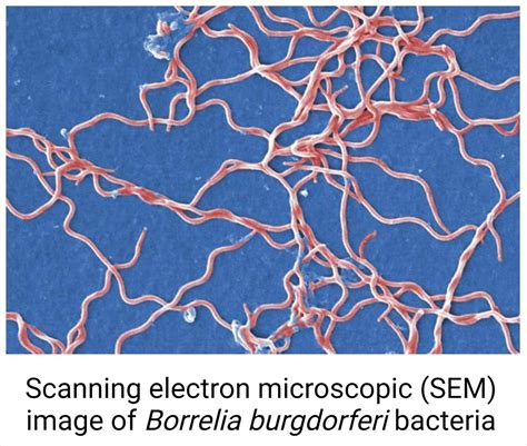 Borrelia burgdorferi (Lyme Disease)- An Overview