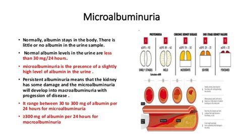 Microalbuminuria in simple way