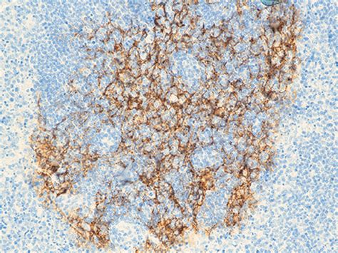 CD23 Antibody - Biocare Medical