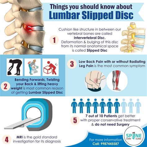 Treatment of Lumbar Disc Herniation or Slipped Disc | Dr. Hrushikesh Mehata