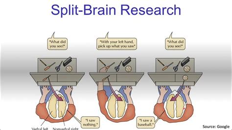 Split Brain Syndrome....Explained! - YouTube