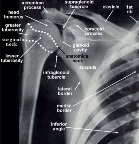 AP of the glenohumeral joint | Radiology schools, Radiology student ...