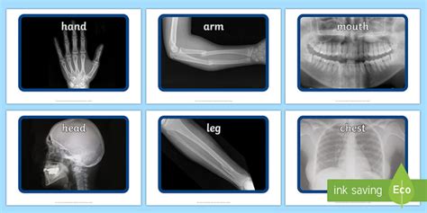 Human Body X-Ray Photos - Display Resources (teacher made)