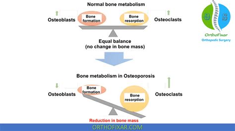 Bone Metabolism - Easy Explained | OrthoFixar 2024