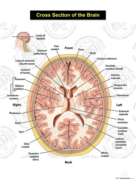 Cross Section of the Brain - Ventricular Level