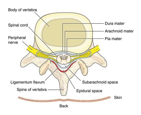 Vertebral Osteomyelitis: Rare Spinal Infection Can Cause Severe Back Pain