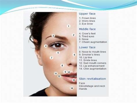 face anatomy landmarks - Tìm với Google | Facial fillers, Dermal ...