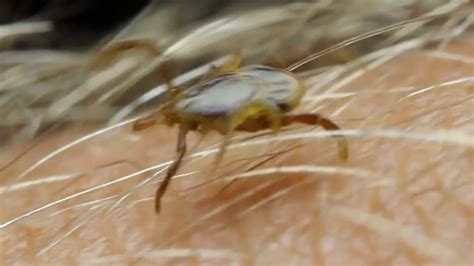 Lice, Parasites, Bugs, Jiggers and Mango Worms! This Documentary Will ...