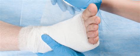 Metatarsal Stress Fracture Doctor in St. Louis, MO | Missouri Foot & Ankle