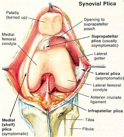 Plicae - Knee & Sports - Orthobullets