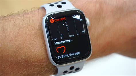 apple watch series 4 ecg accuracy online