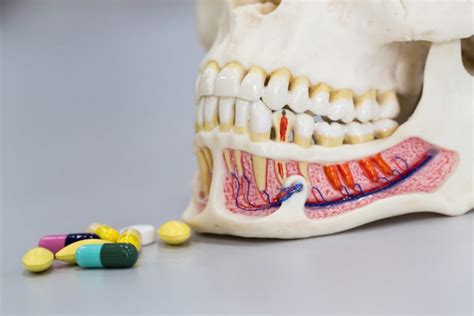 Antibiotics for Gum Disease: Best Prescription and OTC Options