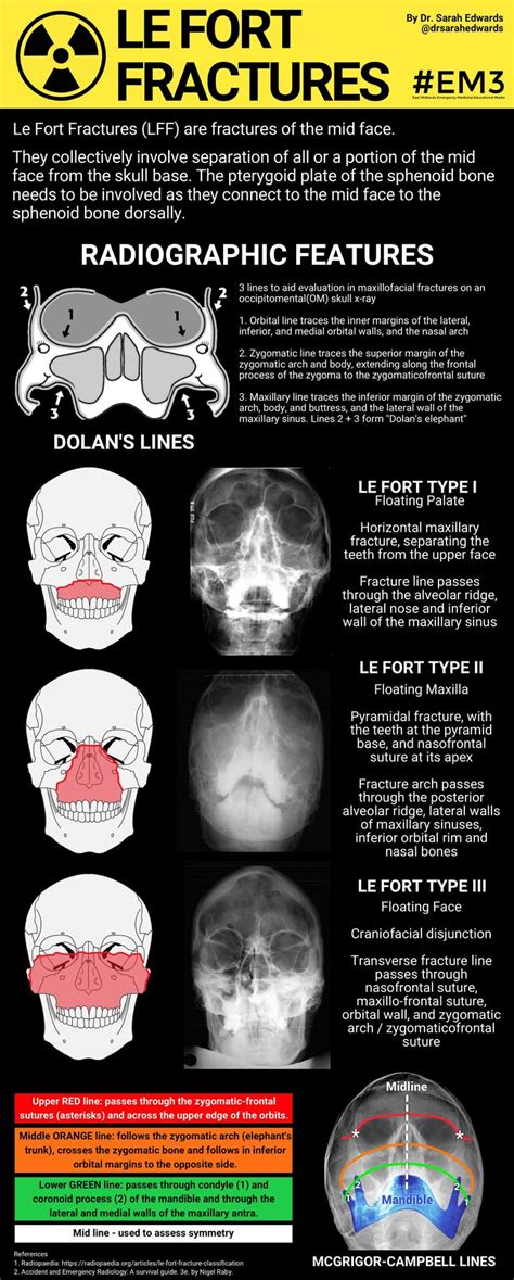 Radiology | Radiology, Radiology student, Radiology imaging