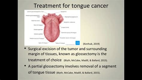 Cancer of Head and Neck - Speech and Swallow Rehabilitation After Partial Glossectomy 2019 - YouTube