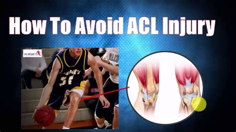 ACL Knee Injury Exercises- Identify Your Risk and Prevent Further ...