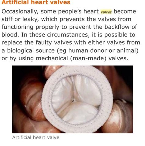 Artificial heart valves. | Heart valves, Artificial heart valve, Valve