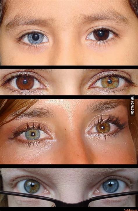 23 best Eye Conditions images on Pinterest | Healthy eyes, Eye exam and Eye facts