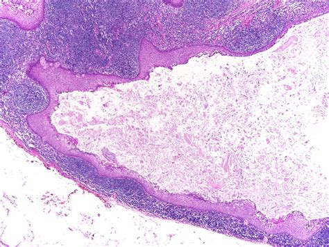 Webpathology.com: A Collection of Surgical Pathology Images