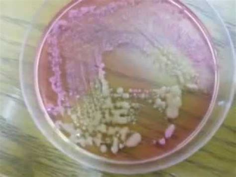 Salmonella Shigella Agar Plates- SS Agar - YouTube