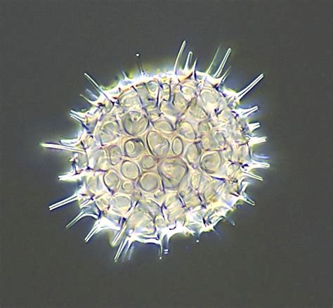 SSM-Echin., South China Sea, Picture of Radiolarian, Microscopic Nature,structures, protozoa ...