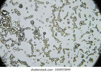 8,533 Mold Microscope Images, Stock Photos, 3D objects, & Vectors | Shutterstock