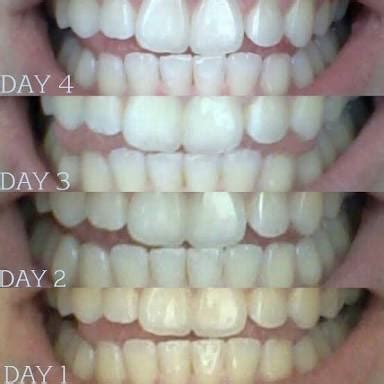 Oil Pulling Before And After