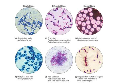 Types of Staining Techniques Used in Microbiology • Microbe Online