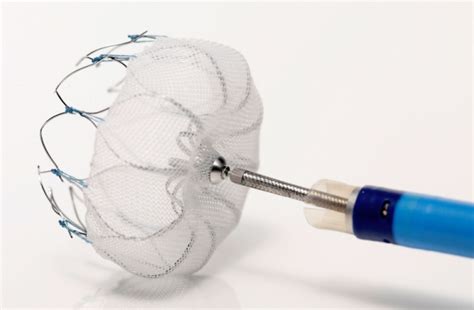 Watchman Device Linked to Low Complications, Successful Procedures