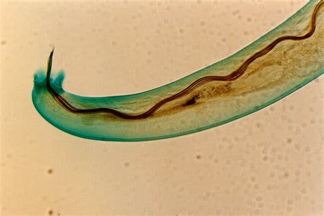 In Hawaii, Rat Lungworm Disease Infects People but Eludes Researchers ...