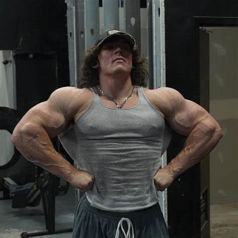 “Ruined His Organs”: 20-Y.O. Sam Sulek Wannabe Claiming to Be Bigger Than the 248 Lbs Beast Gets ...