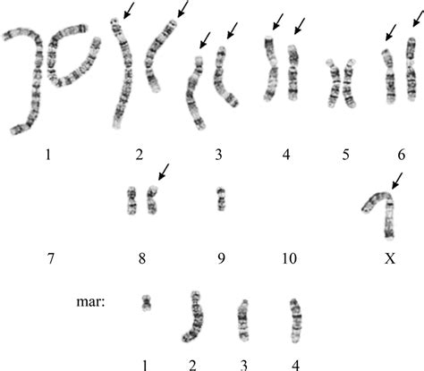 G-banded karyotype of Chinese hamster ovary DXB-11 cell line (main ...