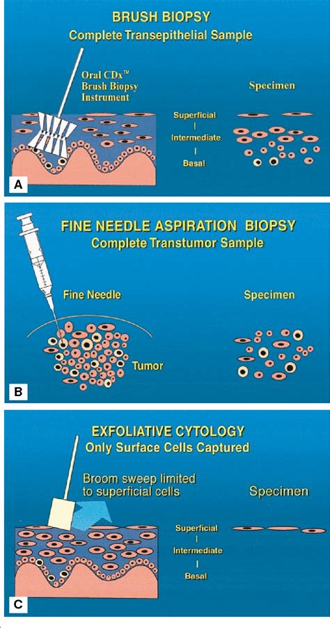 Figure 3 from Improving detection of precancerous and cancerous oral lesions. Computer-assisted ...