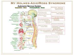 9 Holmes Adie Pupil ideas | syndrome, pupil, eye facts