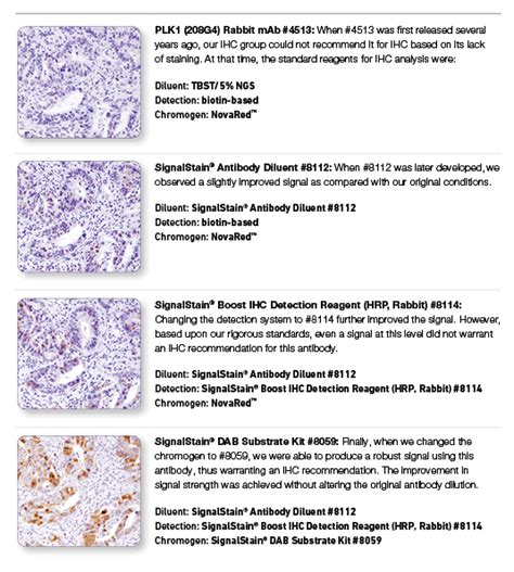 Key to successful Immunohistochemistry (IHC) | Cell Signaling Technology