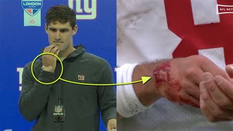 Daniel Jones Details Bloody Hand Injury Suffered vs. Packers