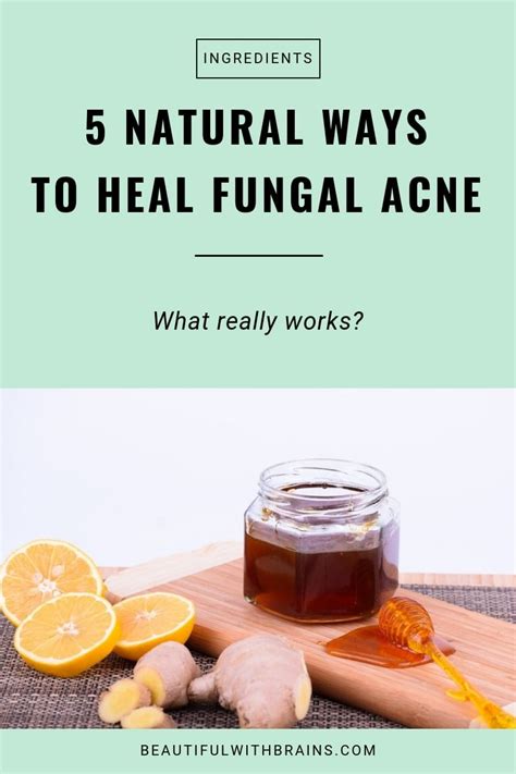 5 Natural Ways To Heal Fungal Acne That Really Work