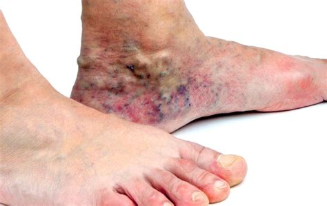 What Causes Skin Discoloration? | USA Vein Clinics