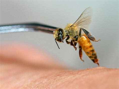 Woman Dies from Bee Acupuncture Allergic Reaction | Breitbart