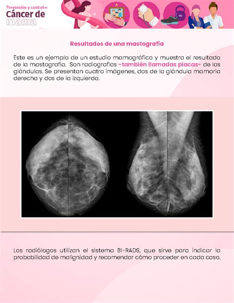 Resultados mastografía 3 - Imagenología - Resultados de una mastografía Este es un ejemplo de un ...