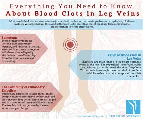 Know The 5 Warning Signs Of A Dvt Blood Clot In Your Leg | Porn Sex Picture