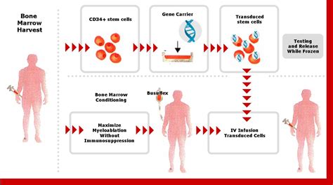 Gene Therapy. Causes, symptoms, treatment Gene Therapy