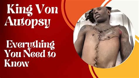 King Von Autopsy Report: In-Depth Analysis of Unsolved Mystery