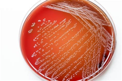 Premium Photo | Bacterial culture growth on blood agar in microbiology