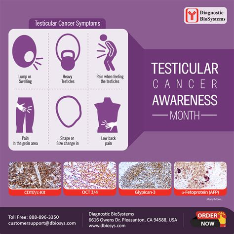 Testicular Cancer Awareness Month - Diagnostic BioSystems -Advanced Tissue Diagnostics & Trusted ...