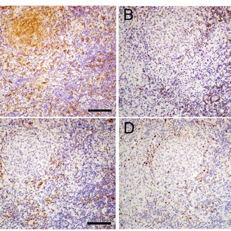 Immunohistological images of immune cells and a cell proliferation ...