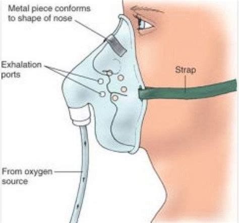 Non-rebreather mask Vs Partial rebreather mask Vs Simple mask | Medical ...