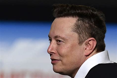 Elon Musk Hair Transplant History and Hair Analysis before and after