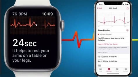 5 Free ECG Apps for Android & iOS | Free apps for Android and iOS