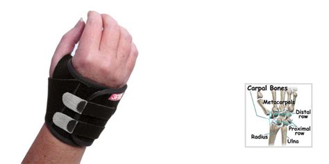 TFCC Ulnar Sided Wrist Pain Anatomy, Diagnosis Treatment, 42% OFF